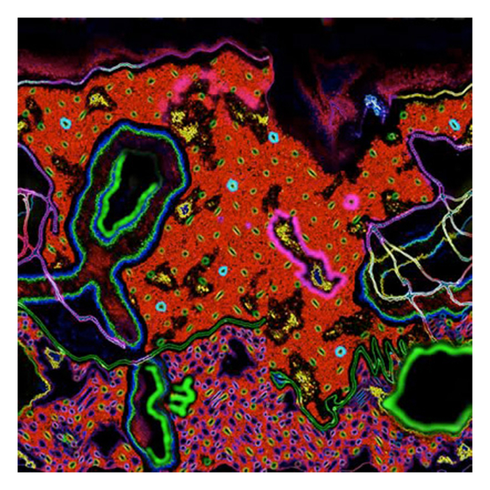 Willie Marlowe Blue Sparks